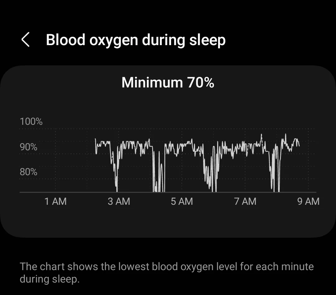 FDA approves sleep apnea detection for Samsung Galaxy Watch